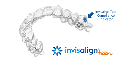 invisalign