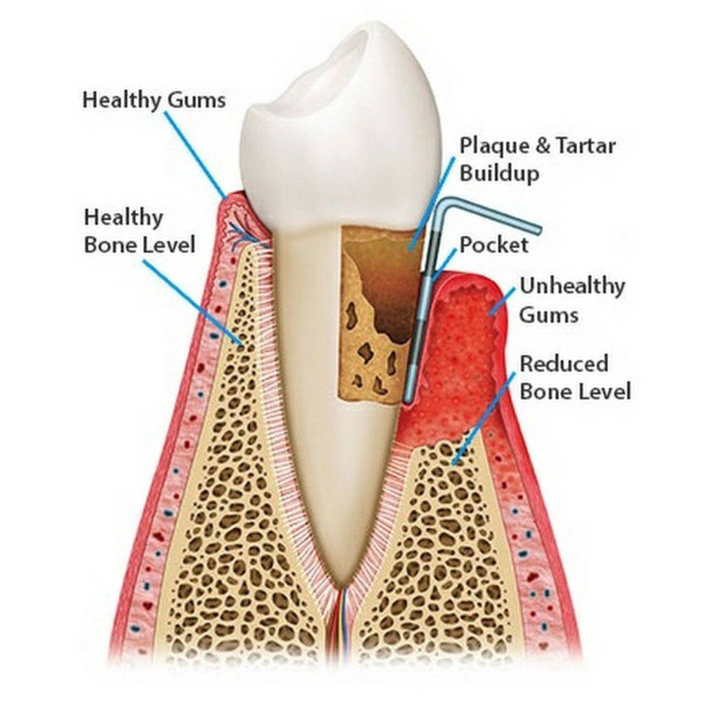 periodontics