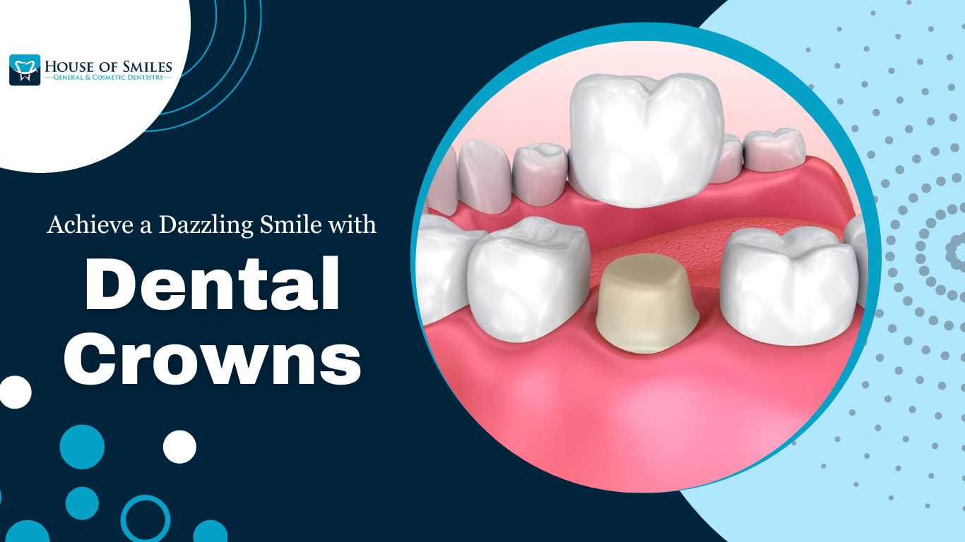 You are currently viewing Dental Crowns in Royal Palm Beach.