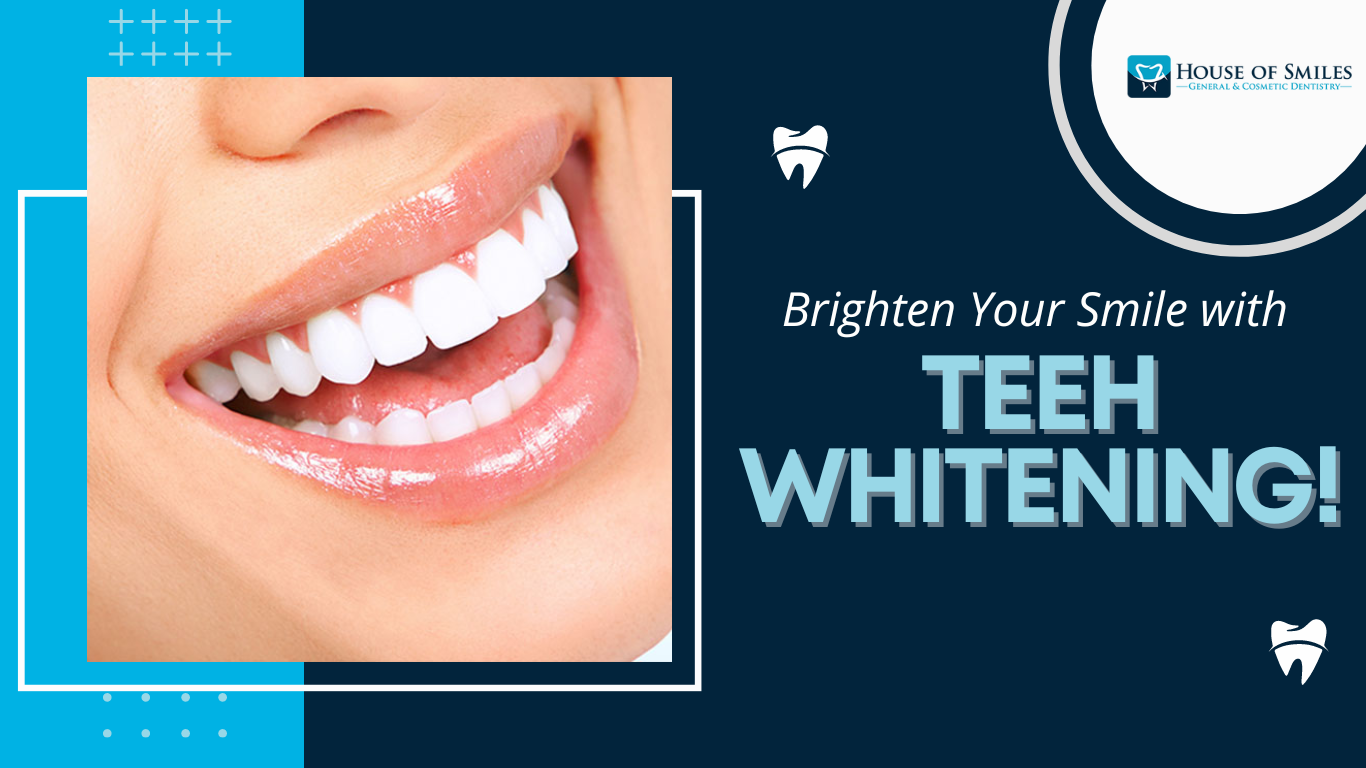 You are currently viewing Teeth whitening in Royal Palm Beach.