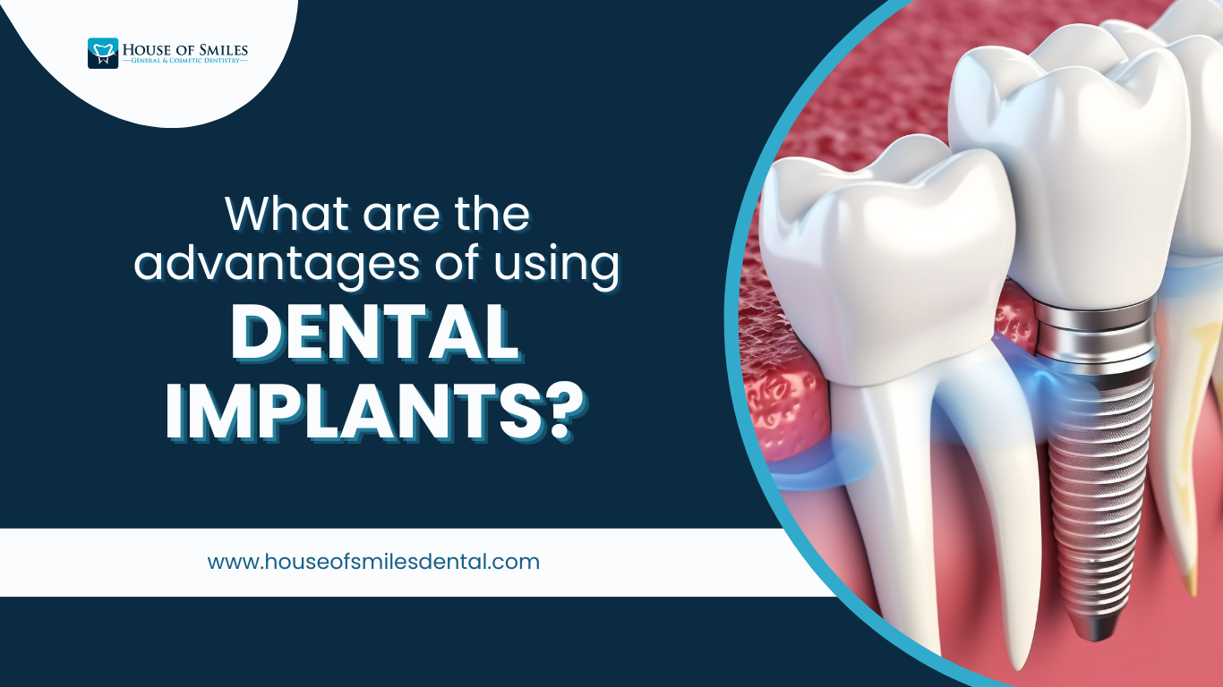 Read more about the article Dental Implants in Royal Palm Beach, FL