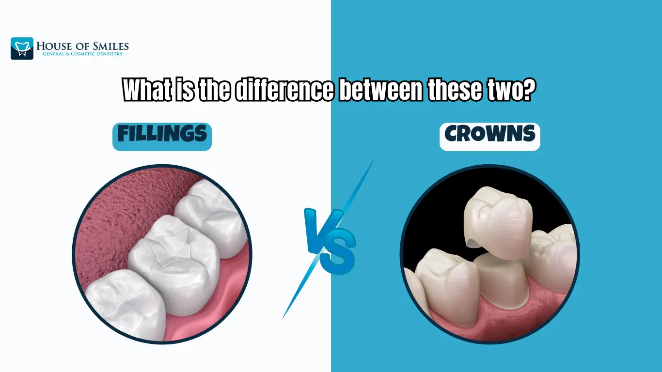 Read more about the article What is the difference between Fillings and Crowns in Royal Palm Beach, FL